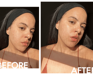 A pele do nosso editor Star Donaldson antes e depois de usar Charlotte Tilbury Magic Water Cream