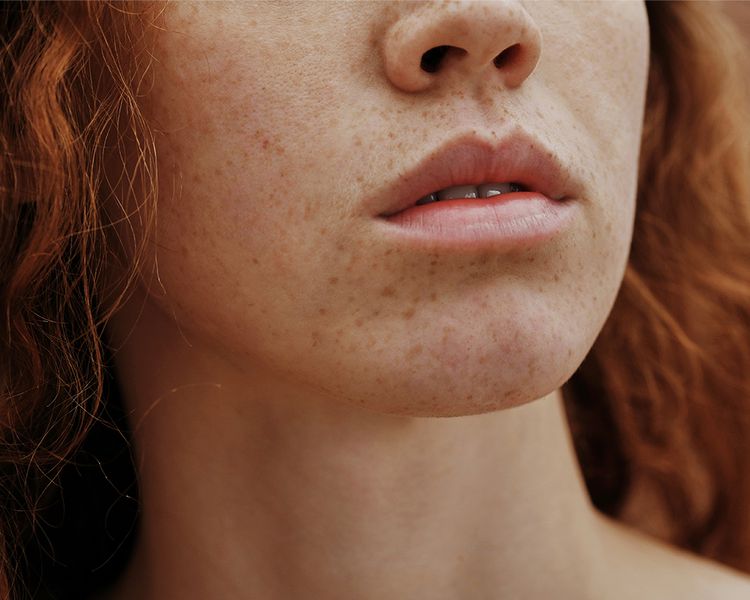 Close-up do rosto de uma linda jovem com sardas e sem maquiagem