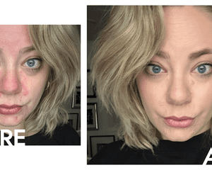 Uma mulher antes e depois de aplicar a maquiagem de Mario Surrealskin Awakening Cinealer.