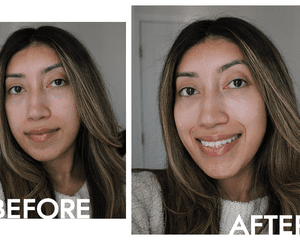 A pele da nossa autora Carla Ayala antes e depois de usar o OLAY Super Serum 5-in-1 Facial Serum