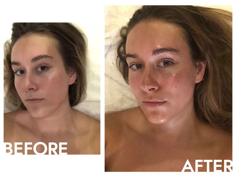 Autor antes e depois do tratamento facial por Shani Darden